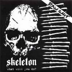 Skeleton (CAN) : What Will You Do?